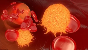 AI Prognostic Tool Confirms Concordance Through Epigenomic Signatures in AML